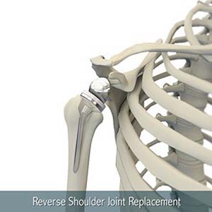 Normal Anatomy of the Foot and Ankle Total Shoulder Replacement