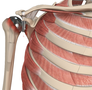 Normal Anatomy of the Foot and Ankle Total Shoulder Replacement