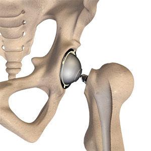 Normal Anatomy of the Foot and Ankle Total Hip Replacement
