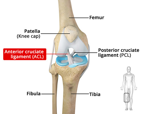 ACL Tears