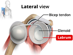 What is Shoulder Instability?