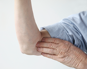 Signs and Symptoms of Elbow Arthritis