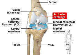 Chondroplasty