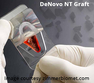 DeNovo graft