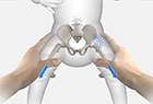 Diagnosis of Developmental Dysplasia