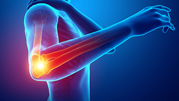 What are the Different Types of Elbow Injuries