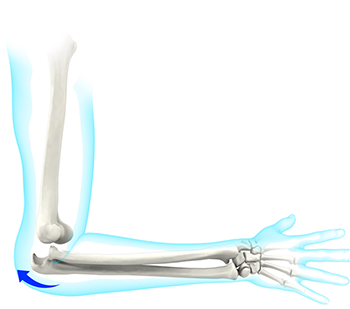 What is Elbow Dislocation