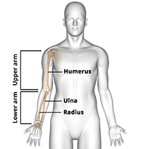 What is Elbow Fracture Reconstruction