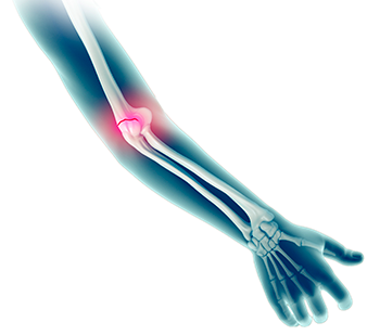 What are the Common Causes of Elbow Pain