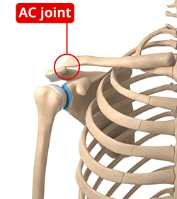 How is a Bankart Tear Diagnosed?