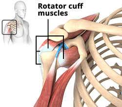 Indications of Shoulder Arthroscopy