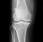 knee Diagnosis