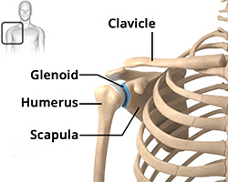 What is Reverse Total Shoulder Replacement?