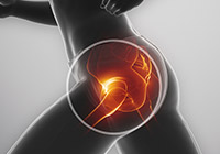 Signs and Symptoms of Hip Fractures