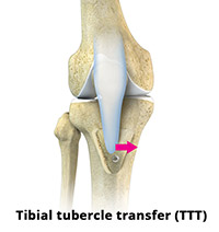 Surgical Treatments