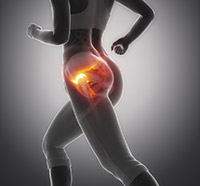 Symptoms of Hip Bursitis