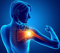 Symptoms of Shoulder Arthritis