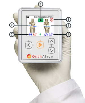 Total Knee Replacement