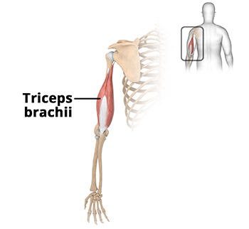 What are Triceps Injuries