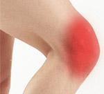 What is Anterior Knee Pain