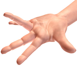 What is Dupuytren’s Contracture?