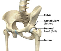 Hip Dislocation