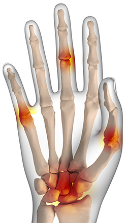 wrist-ligament-disease-overview.jpg